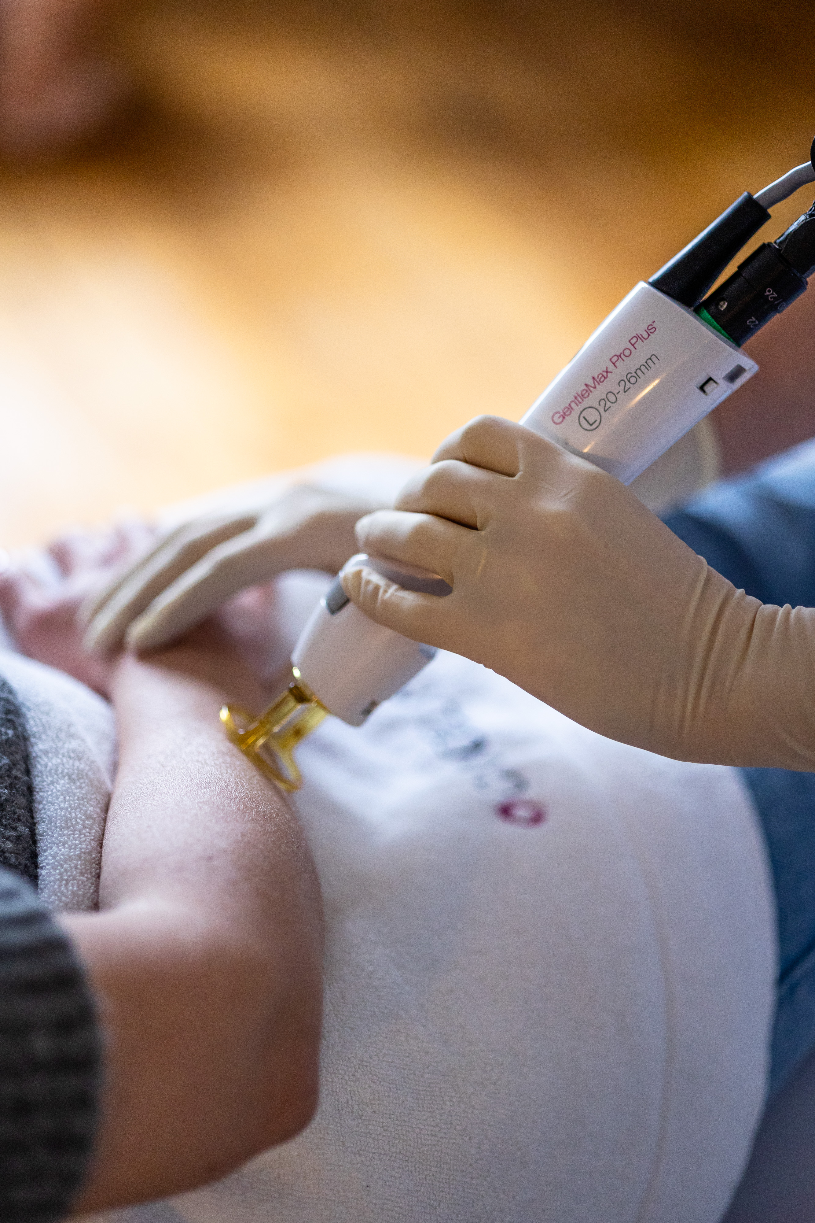 Handpiece GentleMax Pro aplicación láser