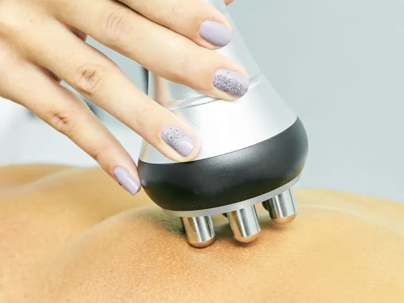 Tratamiento corporal con radiofrecuencia